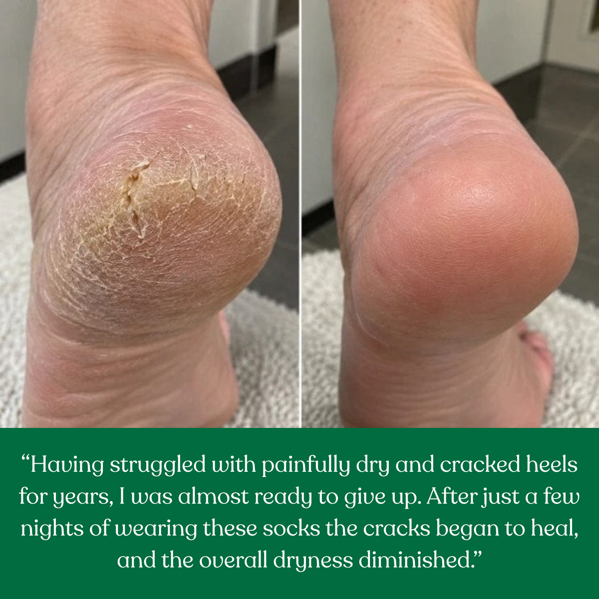 SilkHeel Pro™ Moisturizing Heel Socks
