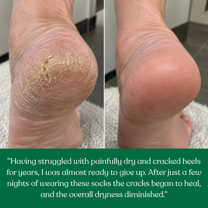 SilkHeel Pro™ Moisturizing Heel Socks