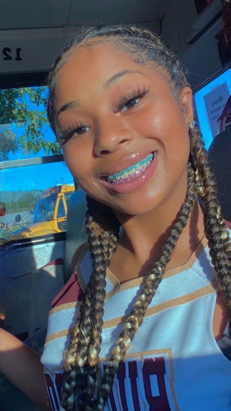 files/braces_p3.jpg