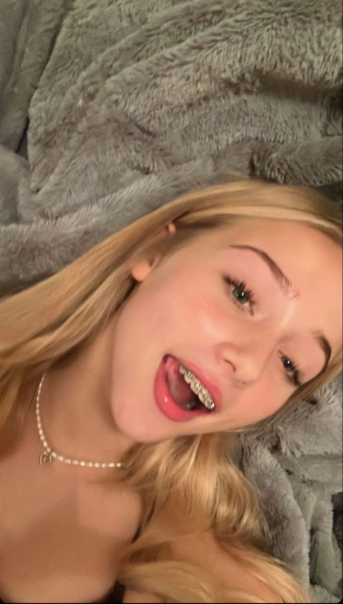 files/braces_photo_p2.jpg
